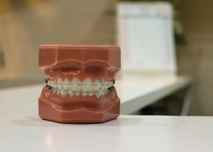 Best Dental Insurance Plans in the USA That Truly Protect Your Smile